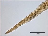 Philonotis mollis (Dozy et Molk.) Mitt. Collection Image, Figure 18, Total 20 Figures